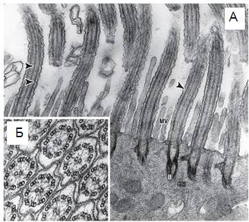 acsonema.jpg