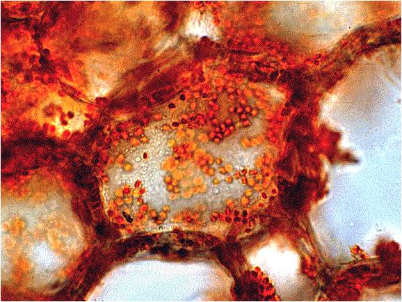 hromoplasti1