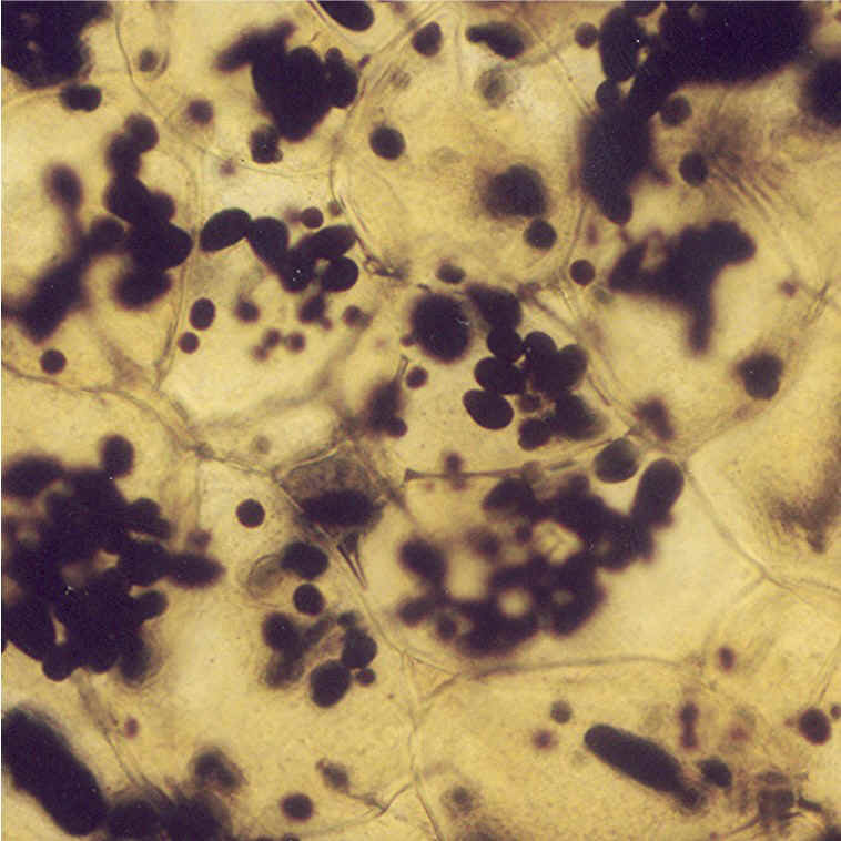 levkoplasti1