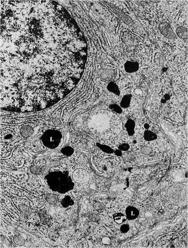 lizozom1