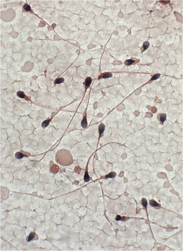 spermatozoidi3