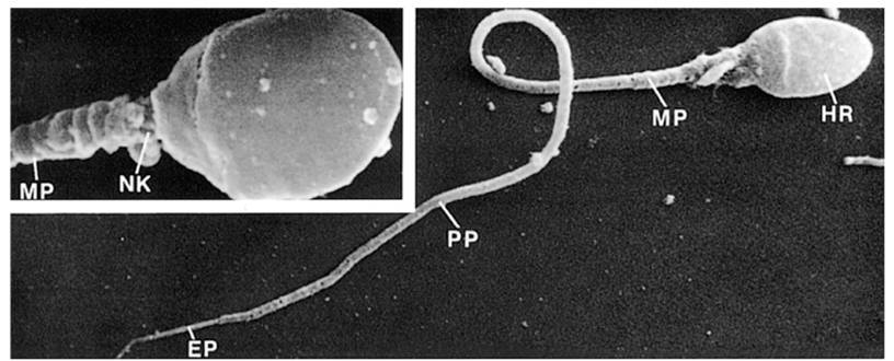 spermatozoidi4