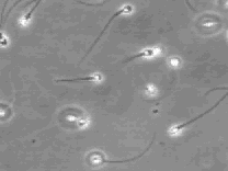 spermatozoidi7